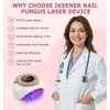 iKeener Nail Lamp &Nailfungus Light Treatment Device For Toenail &