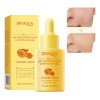 Serum De Cúrcuma Bioaqua Ácido Hialurónico Antioxidante