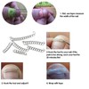 Ingrown Toenail Treatment Kit Glue Free Pedicure Ingrown Toenail Corrective