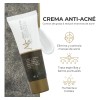 Crema Anti Acné, Control De Grasa, Reduce Manchas. Mc Life
