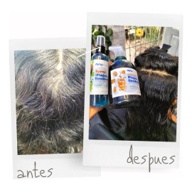 Kit Ninu Shampoo Elimina Piojos 500 Ml + Repelente 125 Ml