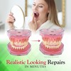 SmileFix Standard Dental Repair Kit - Color Matching Compound -