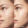 E.l.f. Skin Blemish Breakthrough - Gel Para Combatir El Acné