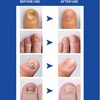 Enriched Vitamins (3 Bottle) Fungus Clear Premuim Probiotic Improves Toe