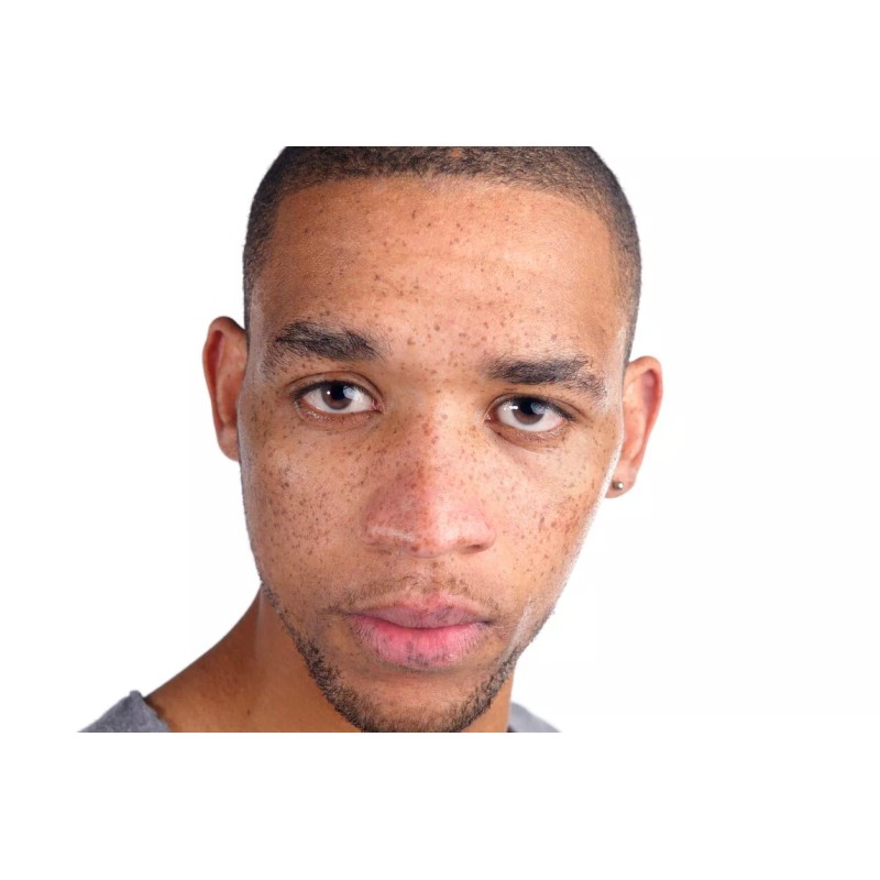 A3 Lemon Face Cream | Brightening & Control Stubborn Blemishes|400