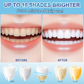 Teeth Whitening Pen(4 Pens), Instant Brightening Teeth Whitening Gel, No Sensitivity Teeth Whitening Kit, Effective & Enamel Safe Teeth Whitener, Fast Tooth Whiter Pen Removes Years of Stains