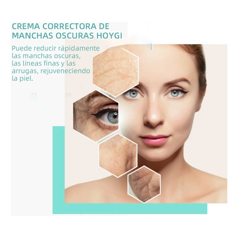 Ab La Crema Correctora De Manchas Aclara Las Manchas Oscuras