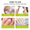 Compuesto completo para tratamiento de tiña Efero Nails, color blanco