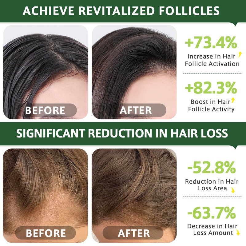 Rinforzante Capelli al Rosmarino 120 ml-Olio di Rosmarino per Capelli