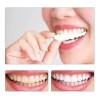 Carillas Estéticas Snap On Smile Veneers Dientes Temporales