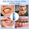 Mullein Gum Repair Gel, Teeth Whitening Essence Pen, Gum Shield