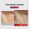 Mascarilla antiarrugas para el cuello 7EA parches reafirmantes para el