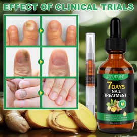 Toenail Treatment Extra Strength, 7 Days Ginger Nail Growth Treatment Repairs Damaged Nails & Cuticles, Supports Fortifies Nails Stronger Growth, Protects Thick, Broken, and Discolored Nails - 60ml