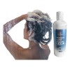 Psoriasis Kit Crema Jabón Urea Shampoo Alquitran Huya