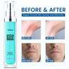 Sielkin Shave Razor Bump Ingrown Hair Aftershave: Treatment Lotion for