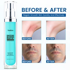 Sielkin Shave Razor Bump Ingrown Hair Aftershave: Treatment Lotion for Sensitive Zone - Men & Women Skin Care Upgraded Formula 1.7 Fl Oz