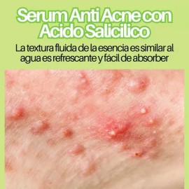 Serums Faciales + Rodillo Gua Sha Masaje Paquete 5pz F