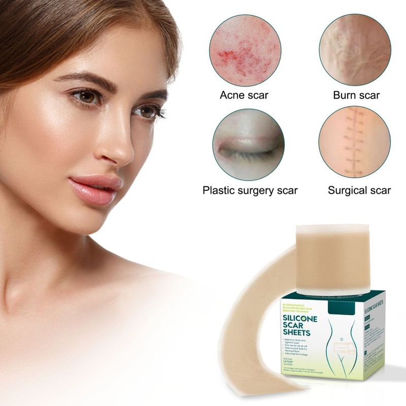 3 Meters Silicone Scar Stickers to Reduce Itching and Redness