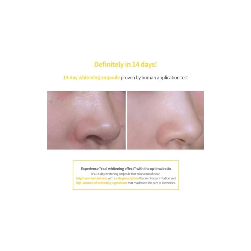 14 DAY VITA WHITENING AMPOULE