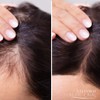 VELFORM Nutritional Hair Application Lotion Stimulates Hair Growth and Prevents
