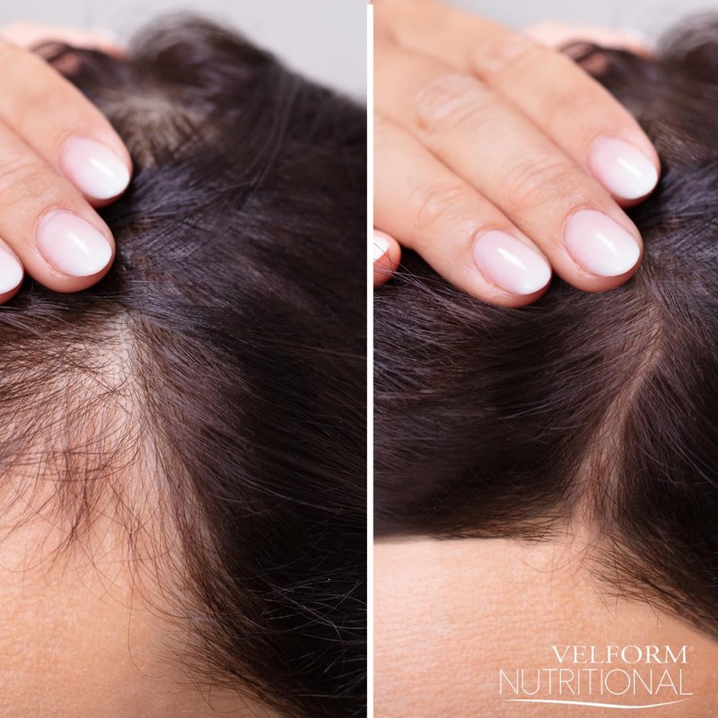 VELFORM Nutritional Hair Application Lotion Stimulates Hair Growth and Prevents