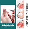 42 Piece Ingrown Toenail Set, Ingrown Toenail Lifter, Toenail Correction