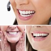 2 Pairs, Temporarily Adjustable for Men and Women, Regain Confidence
