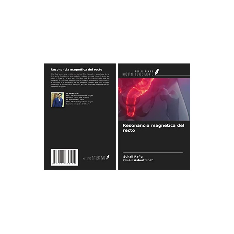 Resonancia magnética del recto