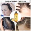 2pcs Shampoo De Jengibre Anti Caspa Caída Cabello