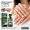 Eelho Líquido Para Hongos En Uñas Cura Hongos Y Onicomicosis