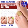 Fungal Nail Patches,32PCS Fungal Nail Patches for Toenails,Nail Repair for