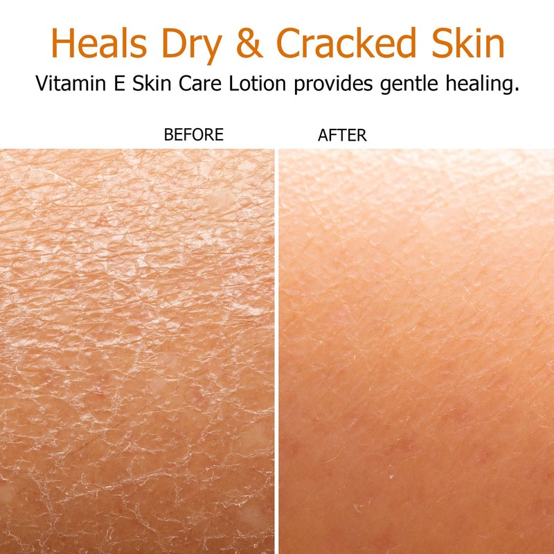 Fruit of the Earth, Vitamin E Lotion, 16 oz