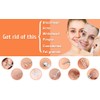 Blackhead Remover Comedone Extractor,15 Pcs Professional Stainless Steel Blackhead Remover