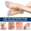 Promifun Gel Toe Caps, 10 Pack Toe Protectors for Women,