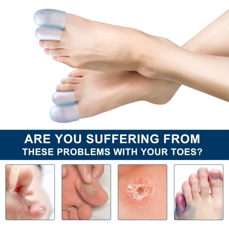 Promifun Gel Toe Caps, 10 Pack Toe Protectors for Women,