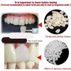 VEZE Tooth Repair Kit-Thermal Fitting Beads Granules and Fake Teeth