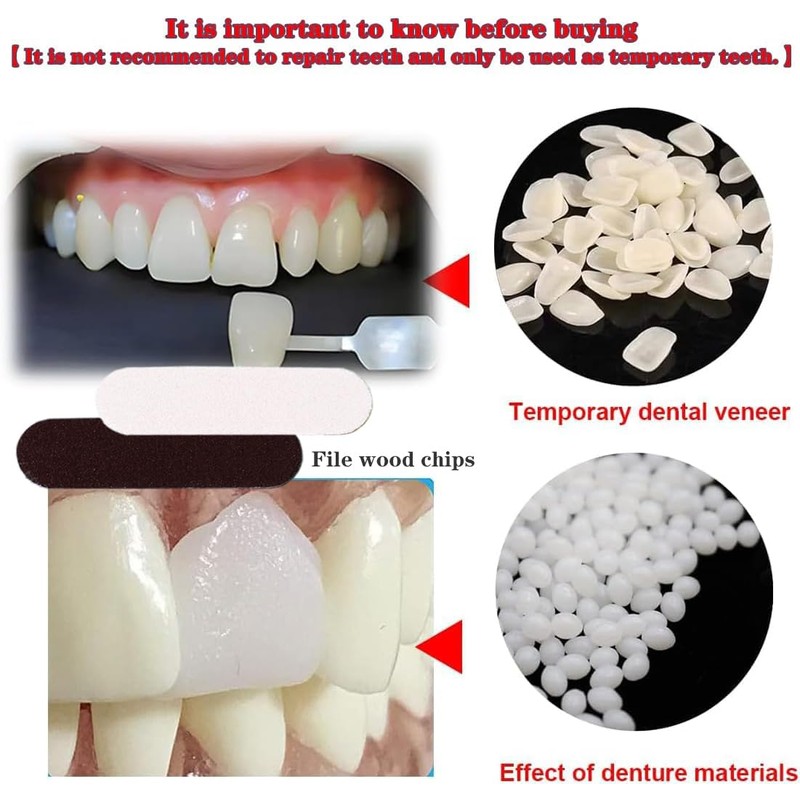 VEZE Tooth Repair Kit-Thermal Fitting Beads Granules and Fake Teeth