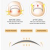 Ingrown Toenail Correction Patch Ingrown Nail Corrector Nail Insert Buckle