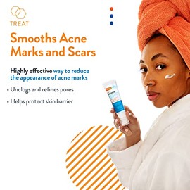 AcneFree Retinol Blemish Mark Resurfacing Serum with Hyaluronic Acid, and Niacinamide  Helps to Reduce the Appearance of Acne Marks  Redness Control  