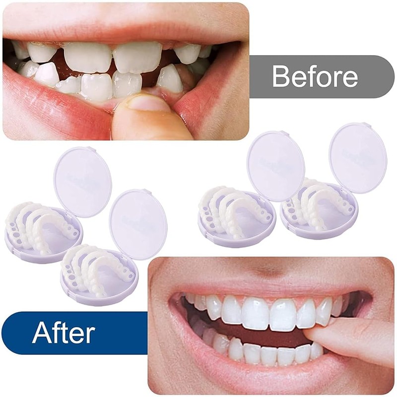 Comioke False Teeth Dentures, 4 Pairs of False Artificial Temporary