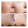 Gc Sérum Facial Reductor Poros Acido Salicílico Anti Acné