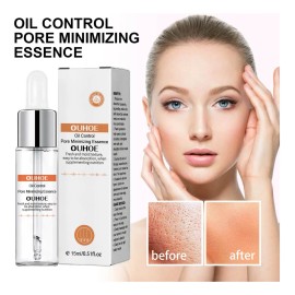 Tratamiento Facial H Pore Para Reducir Los Poros Y Aliviar L