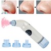 Vacuum Blackhead Removal Electric Pore Cleaner Blackhead Extractor Tool Face