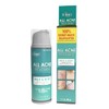All Acne Treatment - Face and Body - Spot and