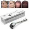 Unbranded 540 Titanium Micro Derma Roller 1.0 mm For Acne