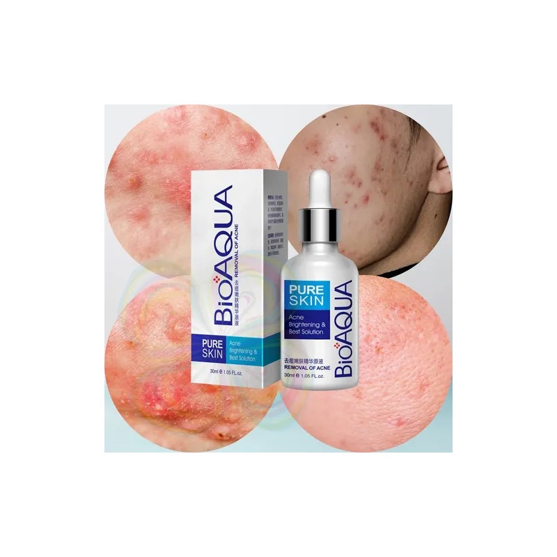 Crema Serum Bioaqua Pure Skin Tratamiento Anti-acne Manchas