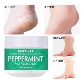 Crema Para Quitar Callos. Remueve Capa X Capa Callos Duros.