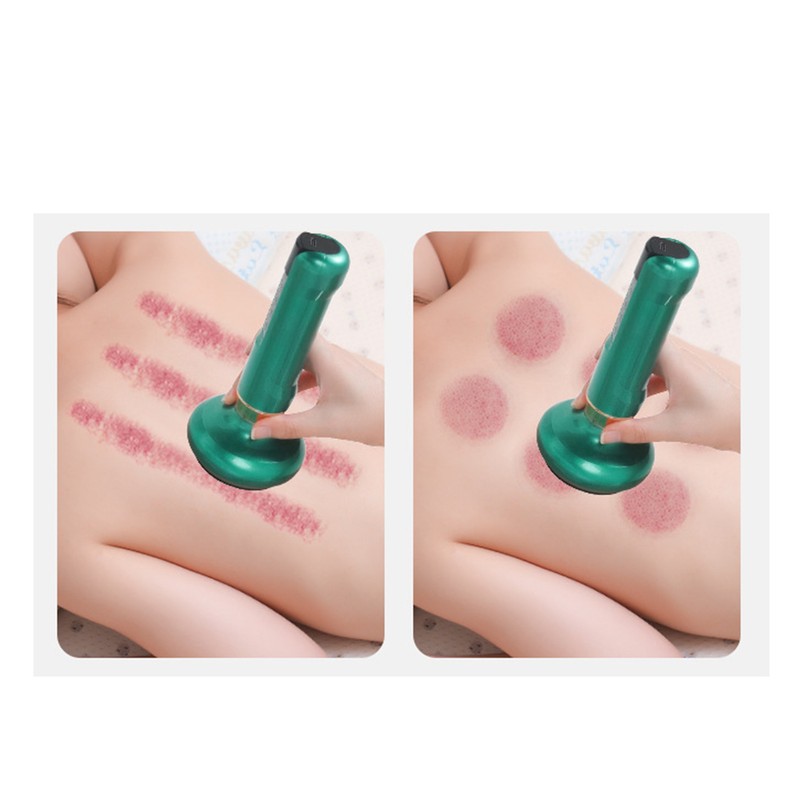 Electric Cupping Gua Sha Massager 6 Levels Suction Electric Gua