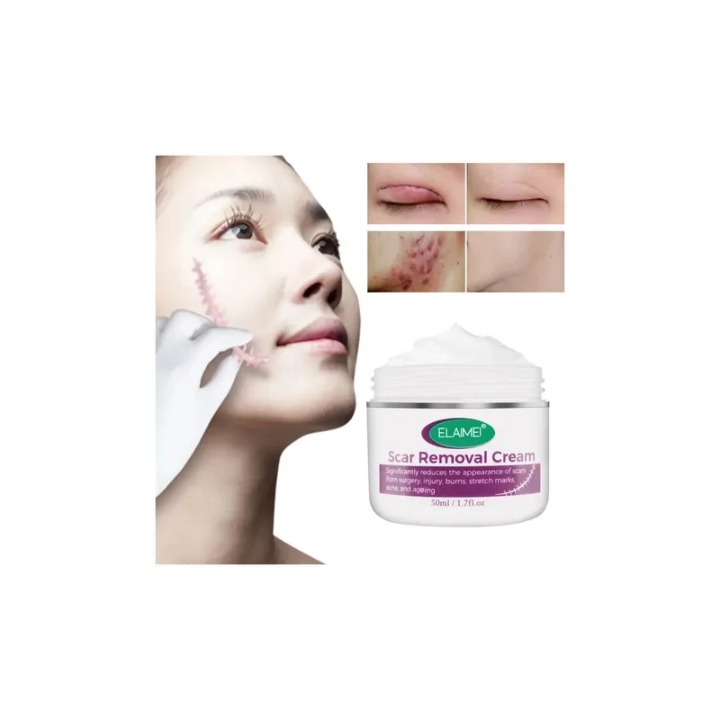 Crema Cicatrices Antimanchas Elaimei Hipoalergénica Sin Parabenos 50ml