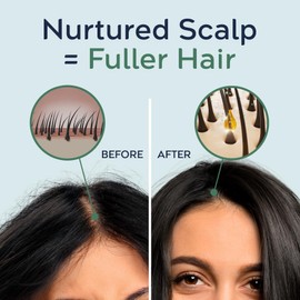 Tree To Tub Rosemary Water Spray for Hair Growth - Fermented Rice Water for Hair Growth Nature's Rosemary Hair Spray & Nourishing Scalp Care